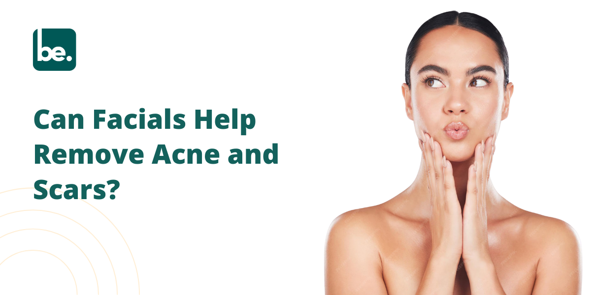 Can Facials Help Remove Acne and Scars?