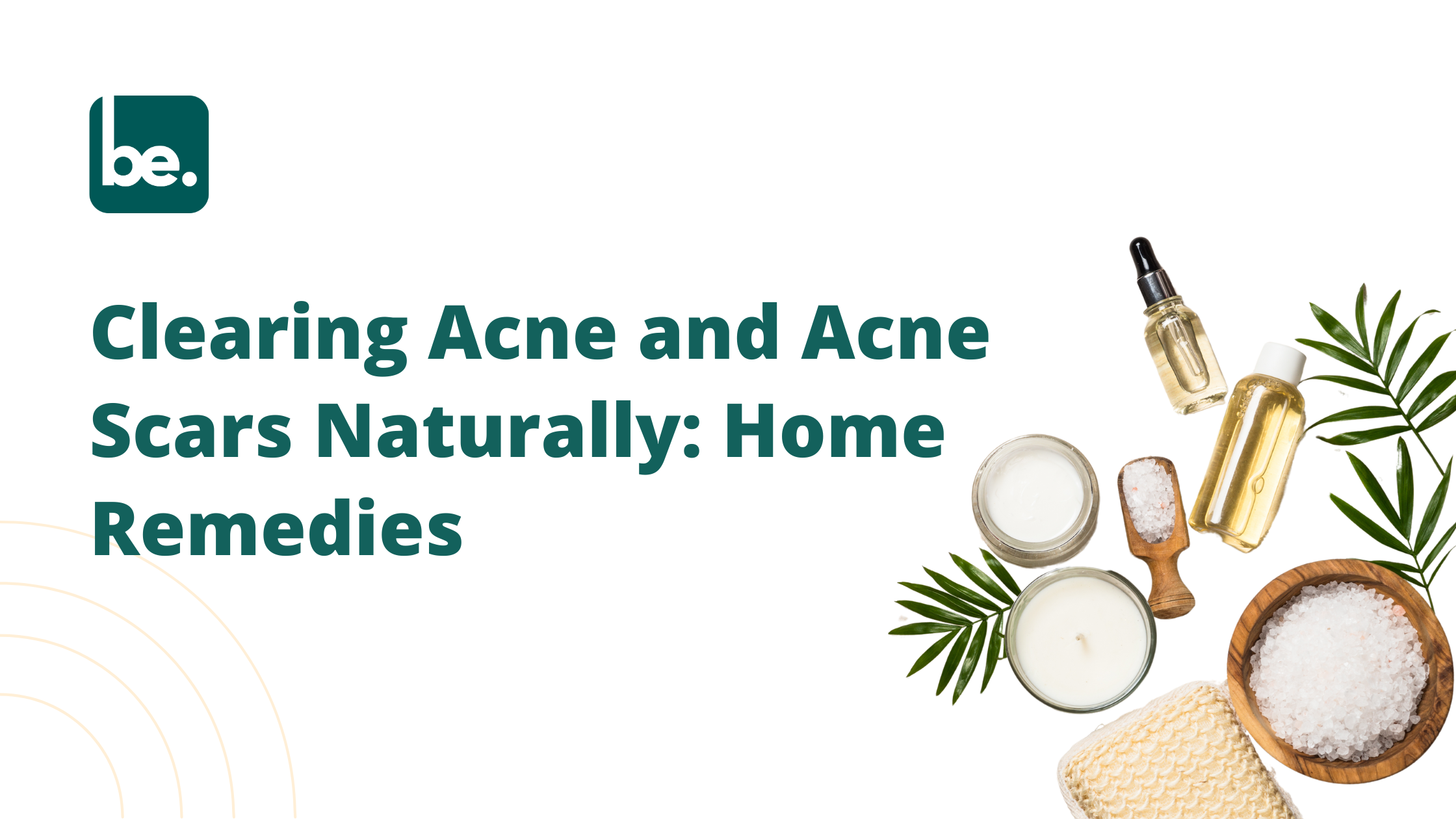 Clearing Acne and Acne Scars Naturally: Home Remedies
