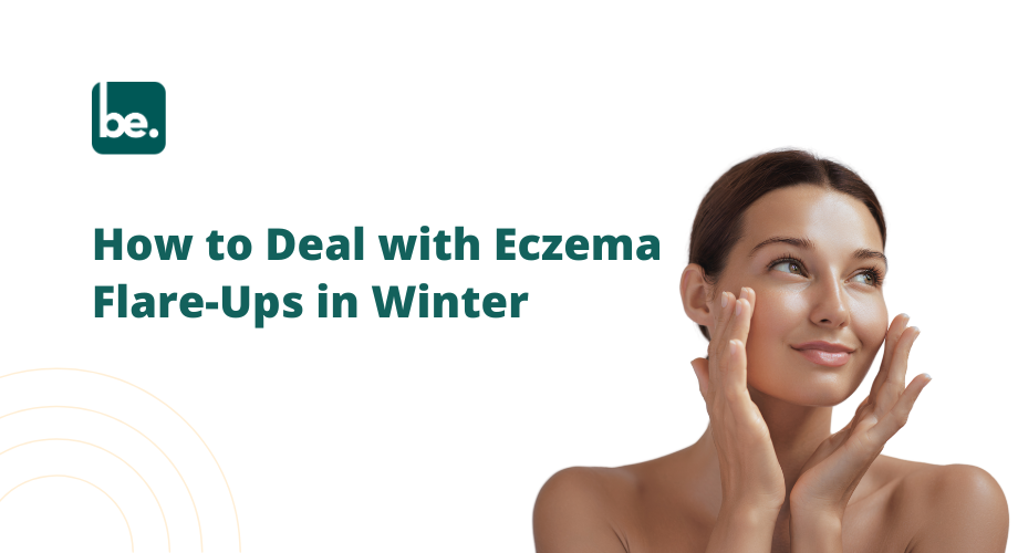How to Deal with Eczema Flare-Ups in Winter