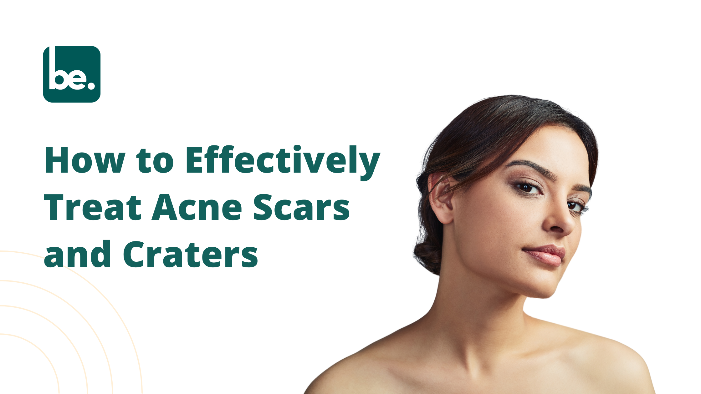 How to Effectively Treat Acne Scars and Craters