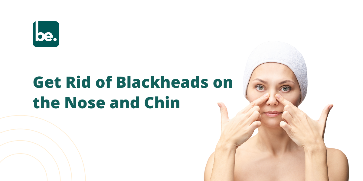 How to Get Rid of Blackheads on the Nose and Chin