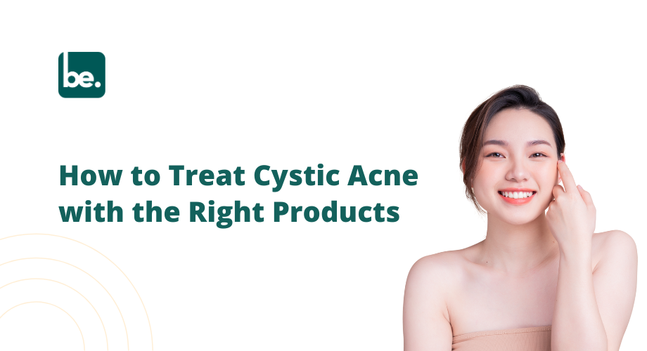 How to Treat Cystic Acne with the Right Products