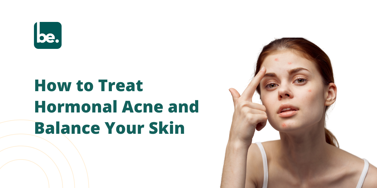 How to Treat Hormonal Acne and Balance Your Skin