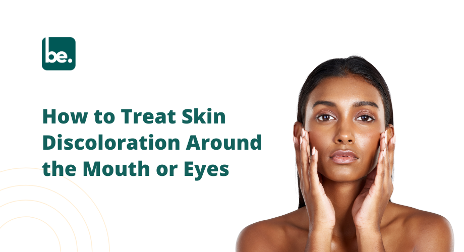 How to Treat Skin Discoloration Around the Mouth or Eyes