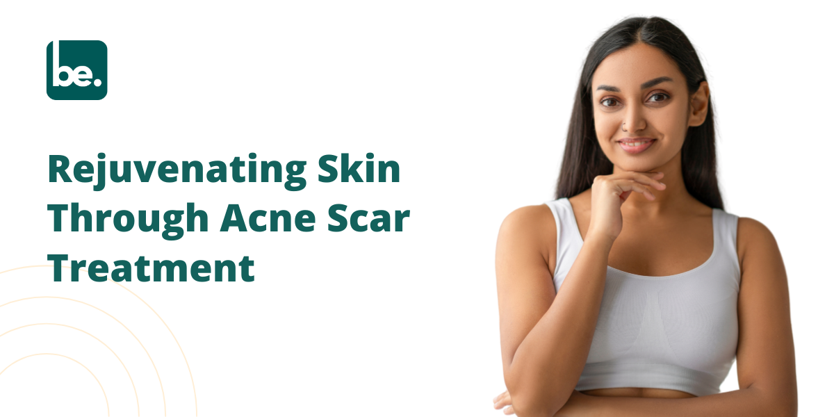 Rejuvenating Skin Through Acne Scar Treatment