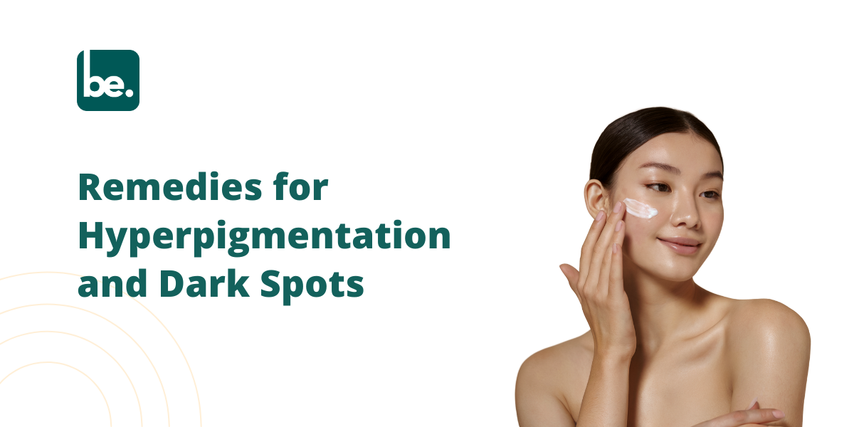 Remedies for Hyperpigmentation and Dark Spots