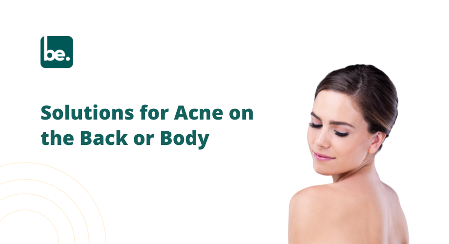 Solutions for Acne on the Back or Body