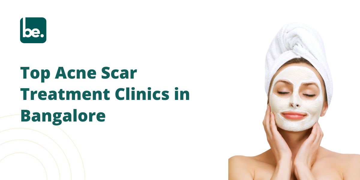 Top Acne Scar Treatment Clinics in Bangalore