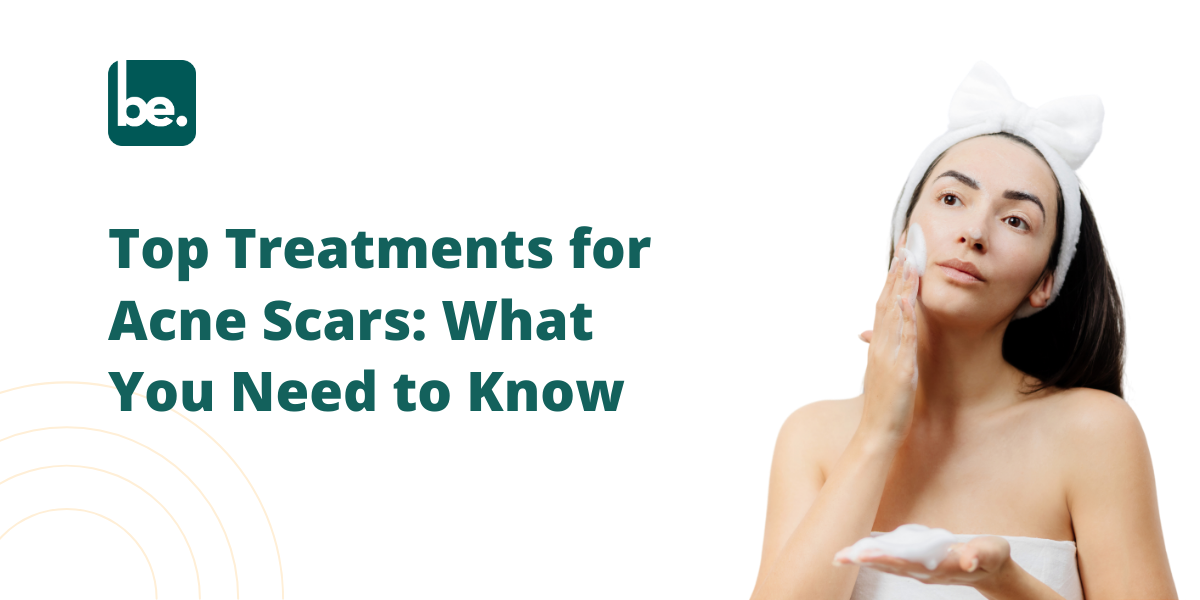 Top Treatments for Acne Scars: What You Need to Know