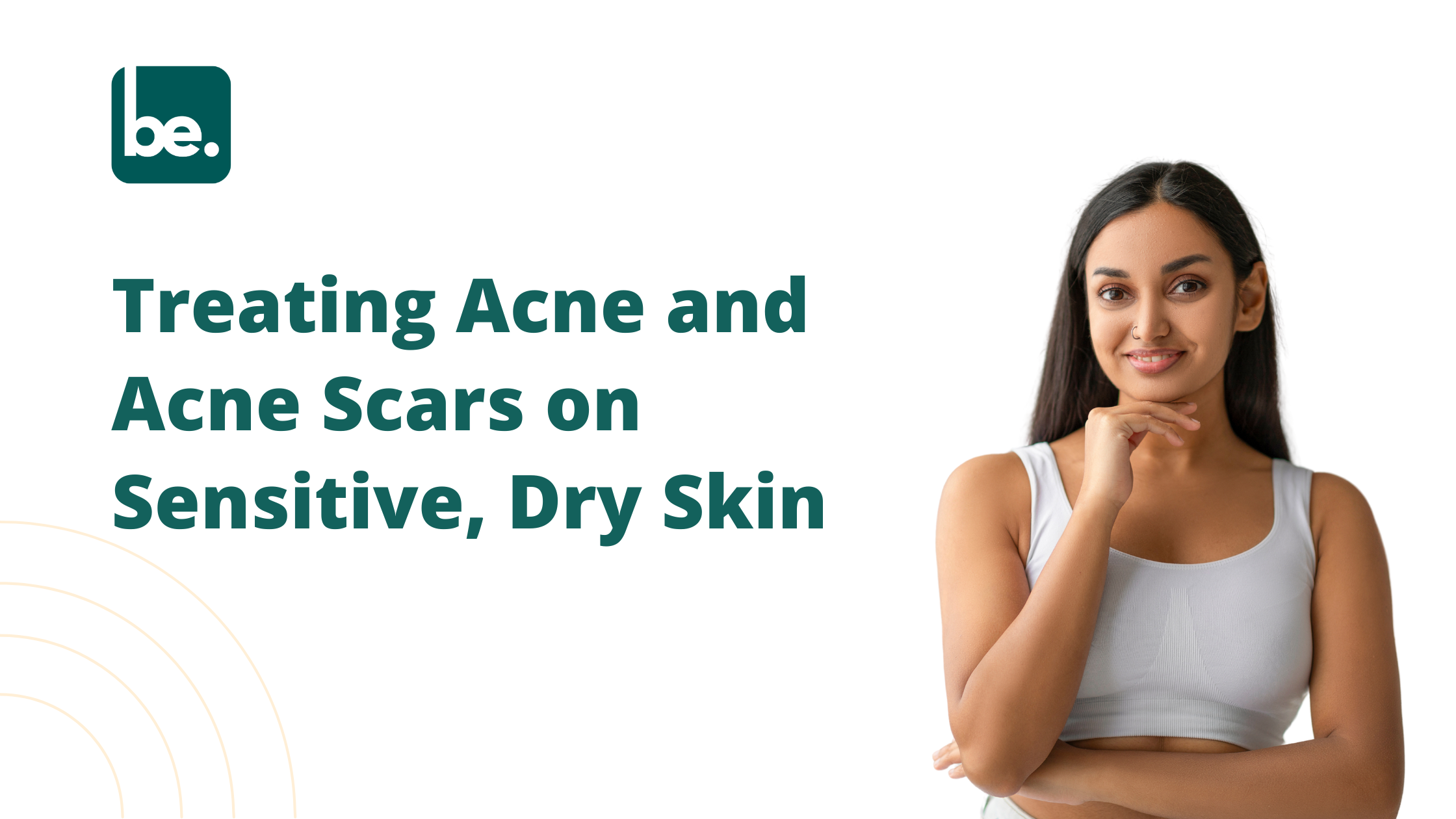 Treating Acne and Acne Scars on Sensitive, Dry Skin