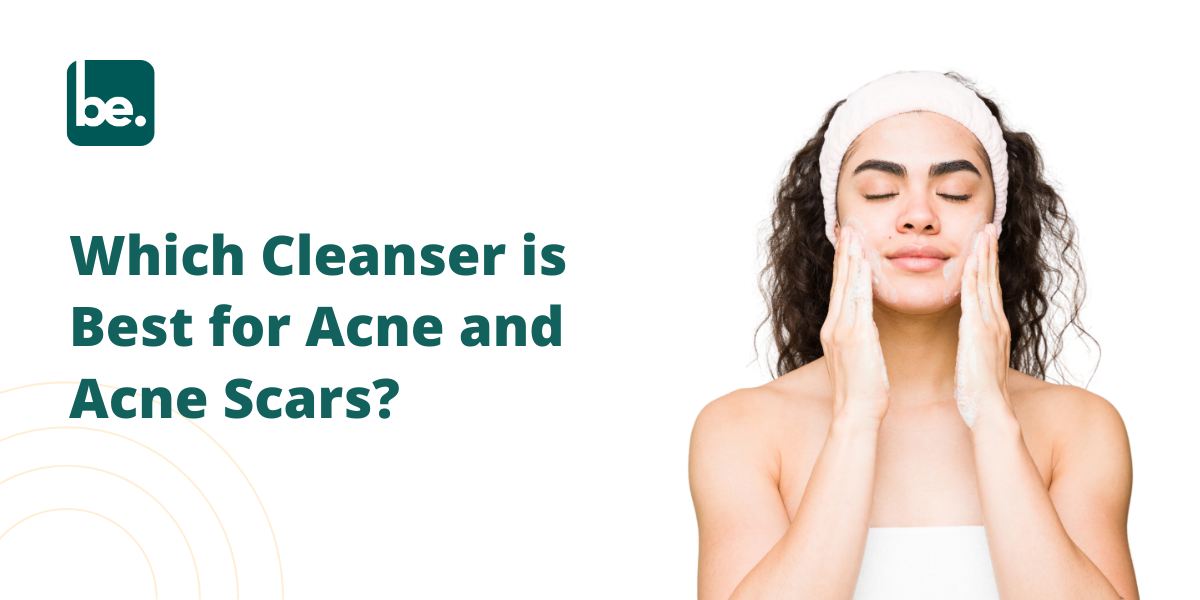 Which Cleanser is Best for Acne and Acne Scars?