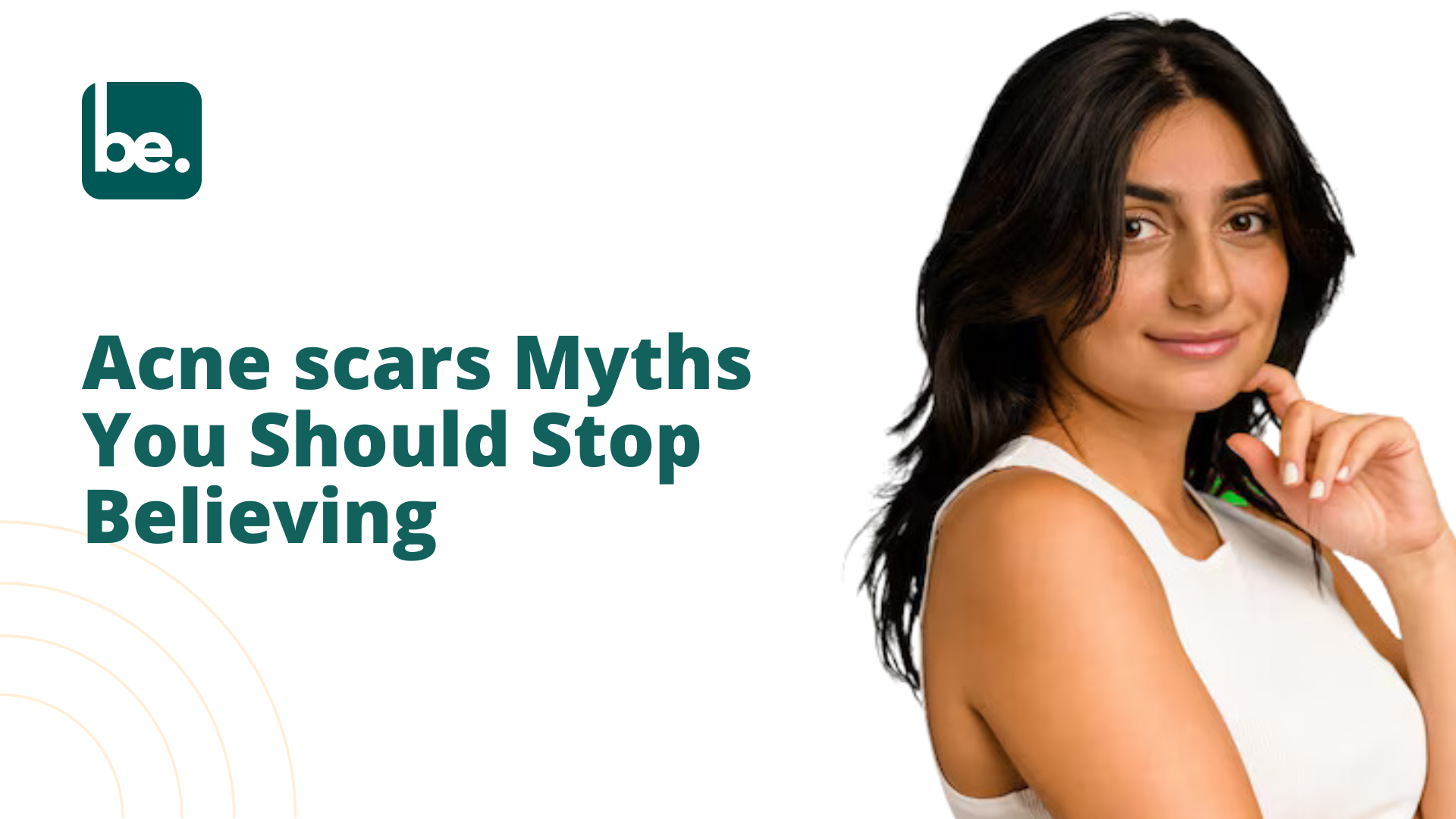 Acne scars Myths You Should Stop Believing