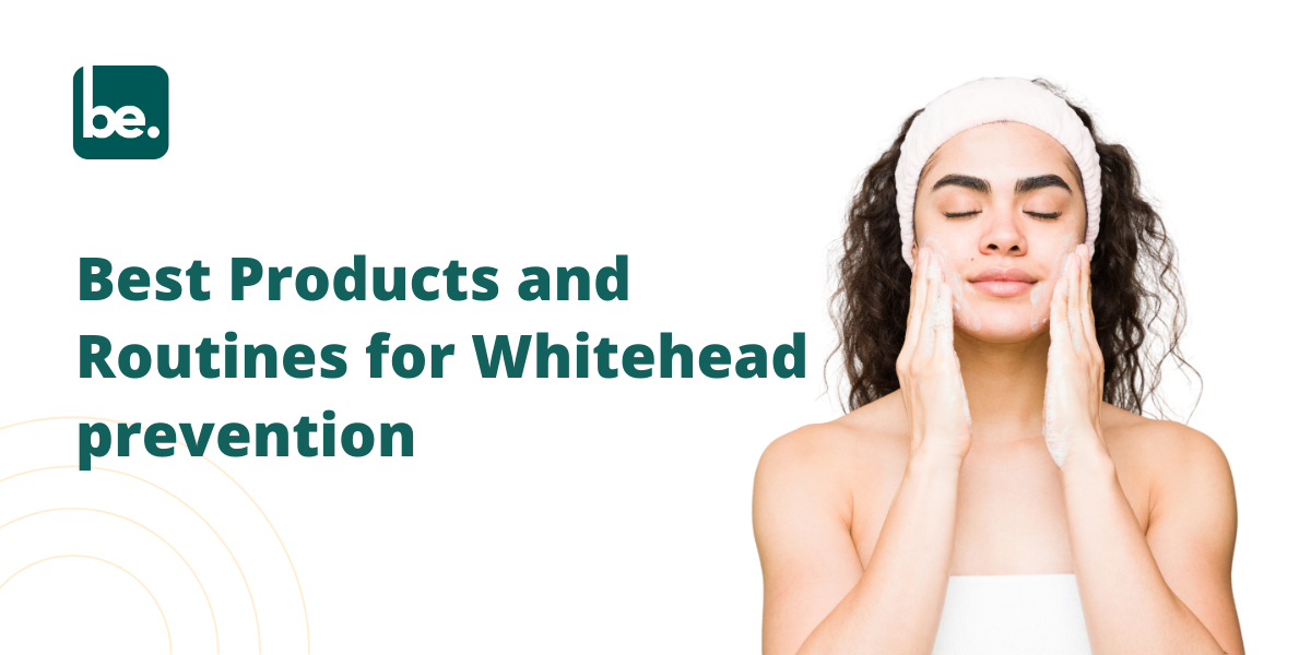 Best Products and Routines for Whitehead prevention