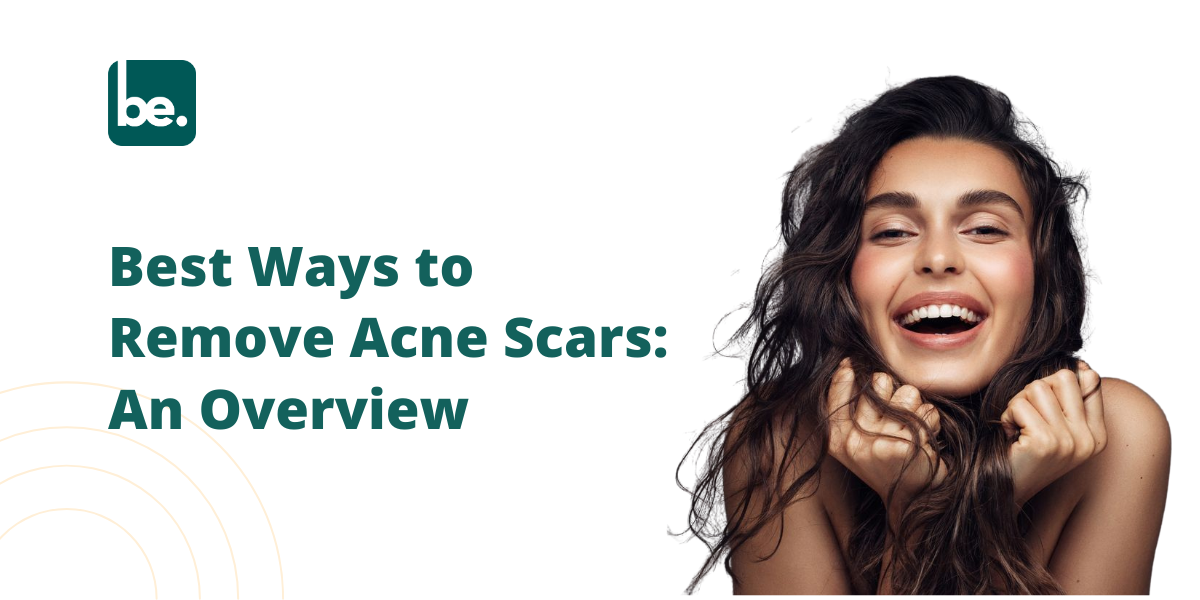 Best Ways to Remove Acne Scars: An Overview