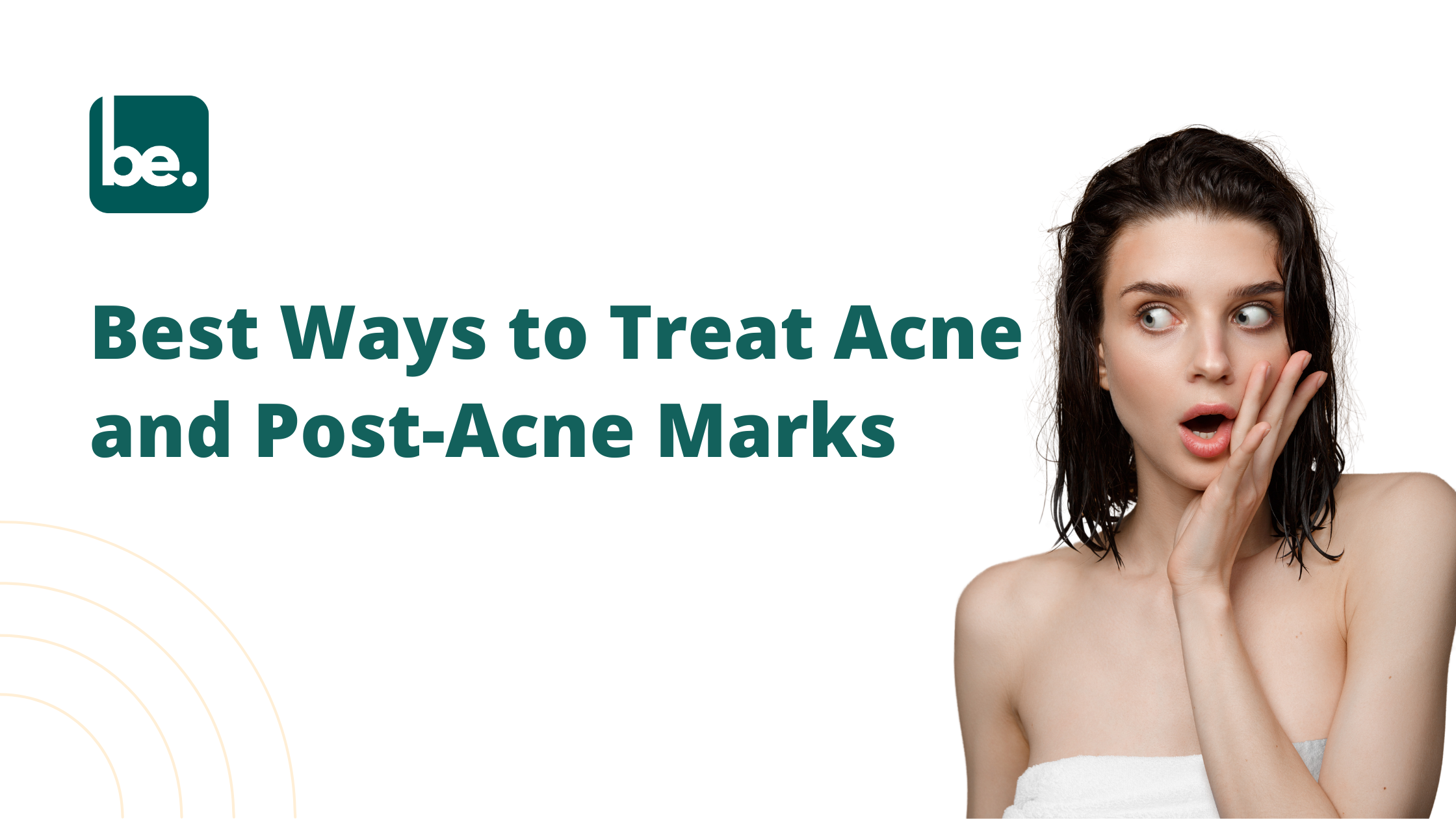 Best Ways to Treat Acne and Post-Acne Marks