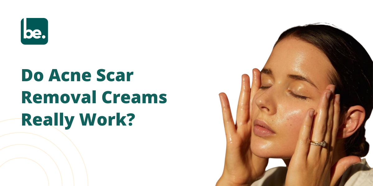 Do Acne Scar Removal Creams Really Work?