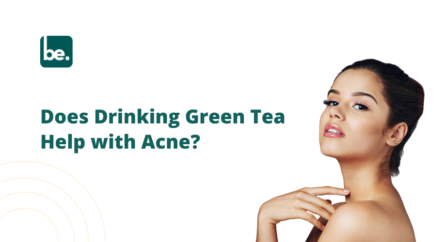Does Drinking Green Tea Help with Acne?
