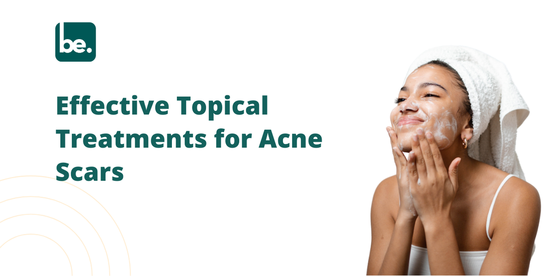 Effective Topical Treatments For Acne Scars Belogical Wellness