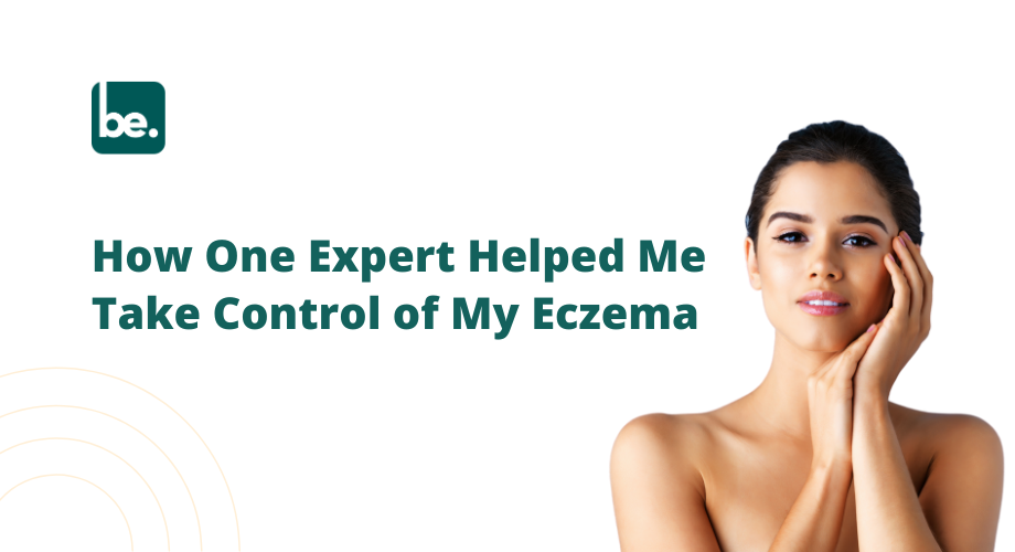 How One Expert Helped Me Take Control of My Eczema