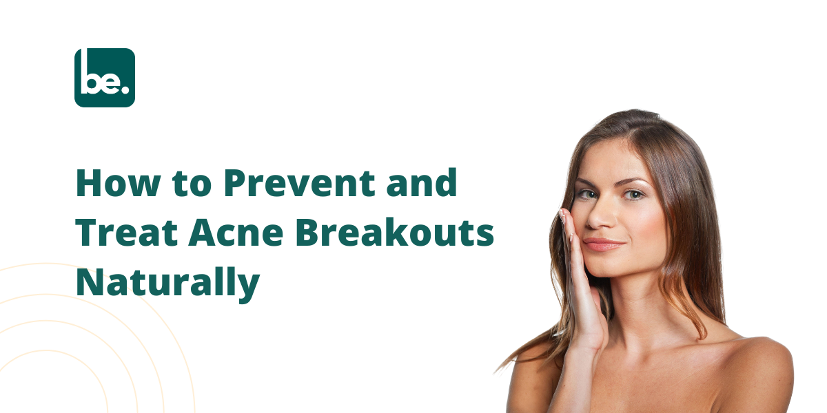 How to Prevent and Treat Acne Breakouts Naturally