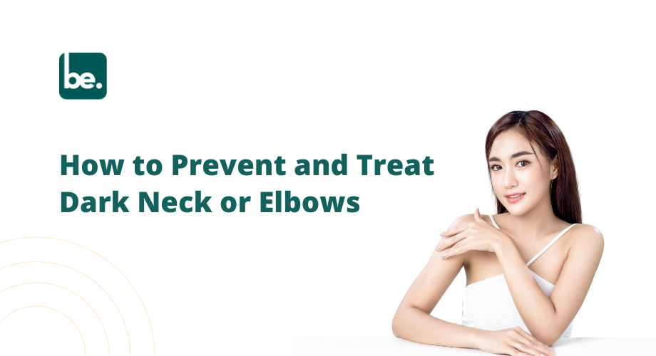 How to Prevent and Treat Dark Neck or Elbows