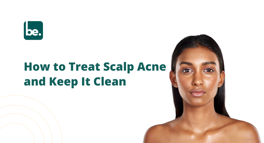 How to Treat Scalp Acne and Keep It Clean