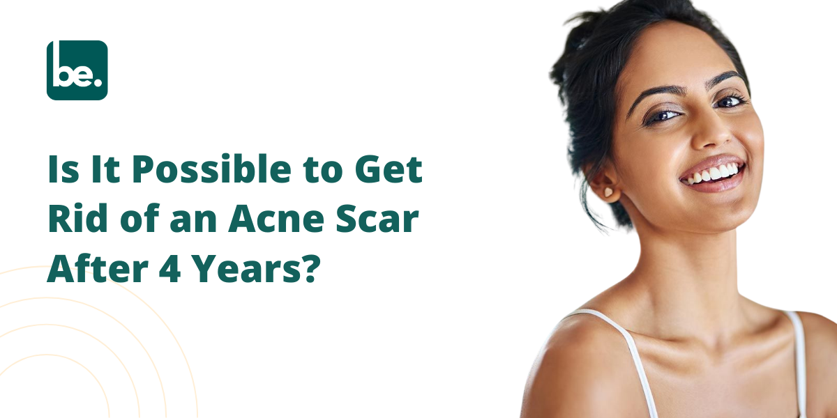 Is It Possible to Get Rid of an Acne Scar After 4 Years?