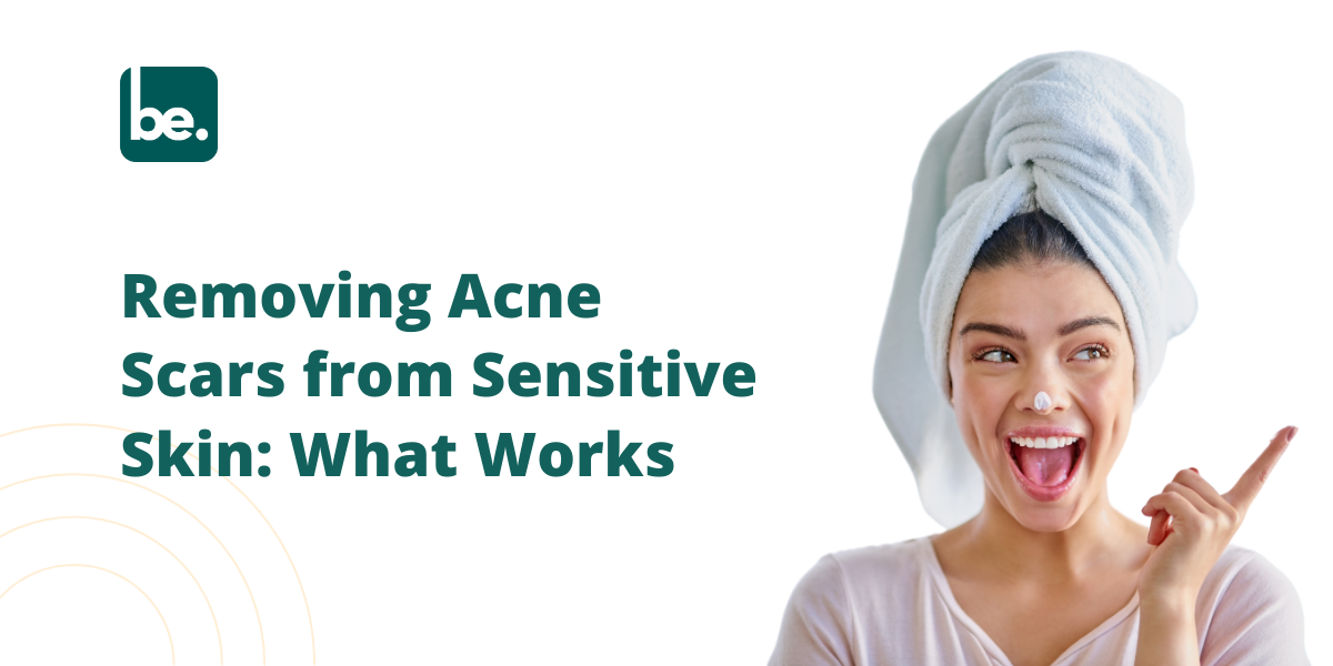 Removing Acne Scars from Sensitive Skin: What Works