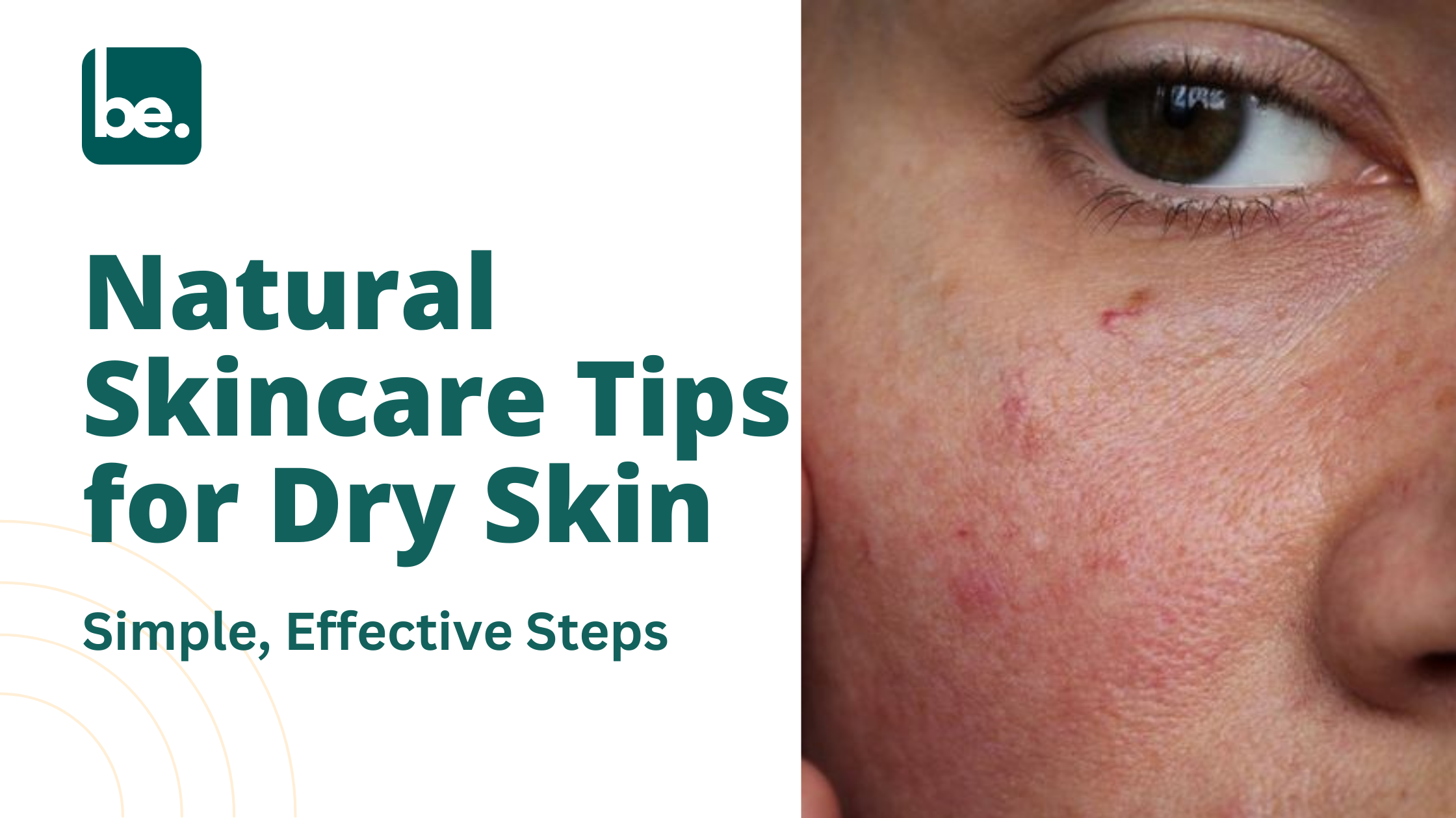 Natural Skincare Tips for Dry Skin: Simple, Effective Steps