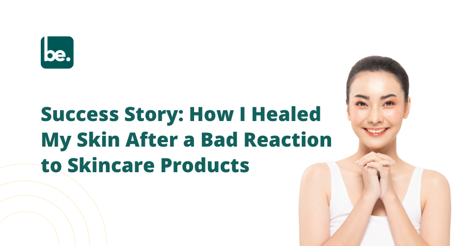 Success Story: How I Healed My Skin After a Bad Reaction to Skincare Products