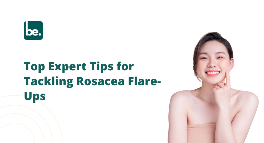 Top Expert Tips for Tackling Rosacea Flare-Ups
