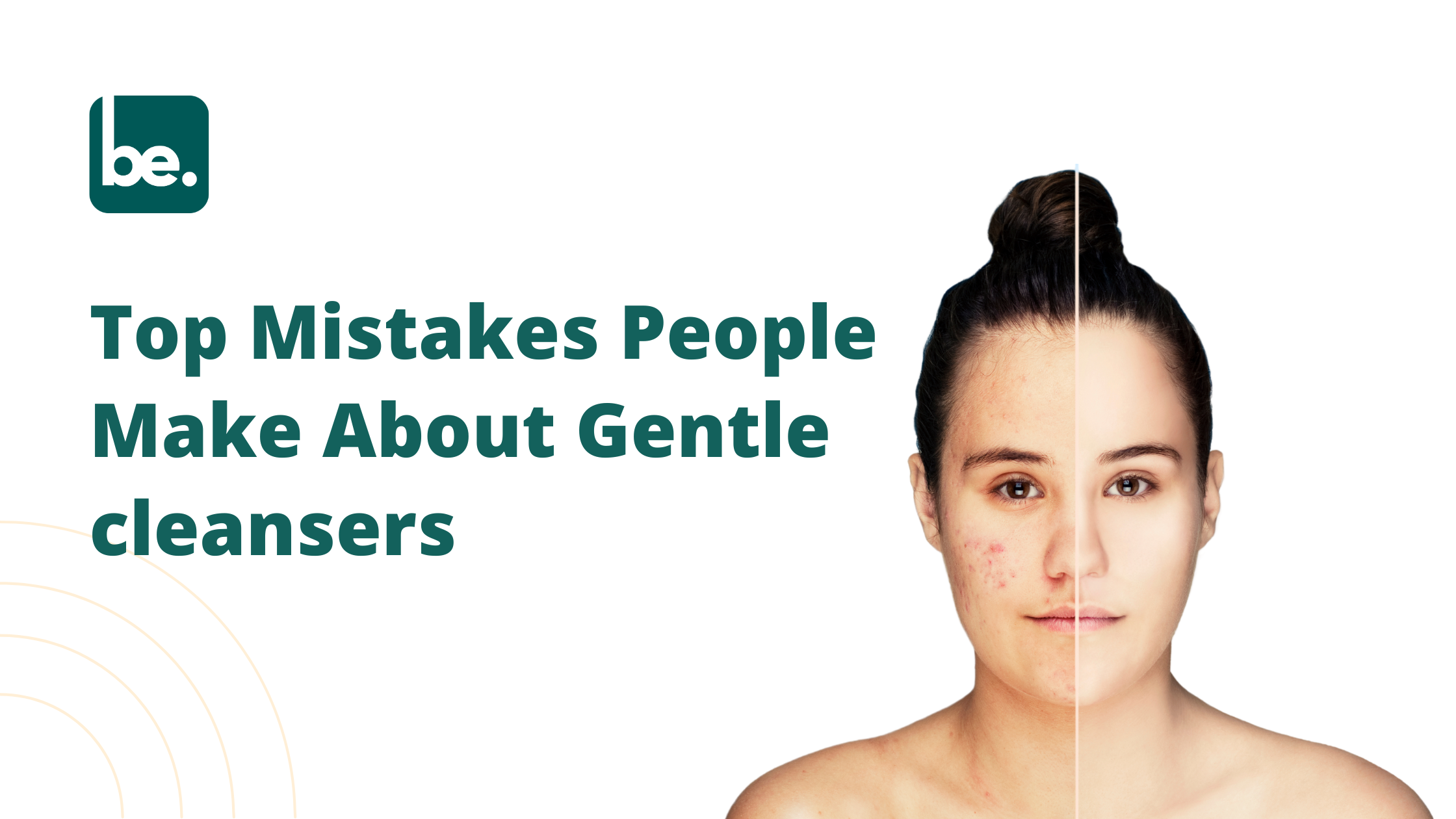 Top Mistakes People Make About Gentle cleansers