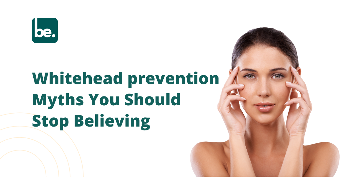 Whitehead prevention Myths You Should Stop Believing